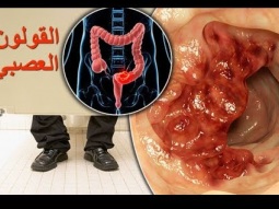 ألم سرطان القولون العصبي | الأعراض - التشخيص والعلاج