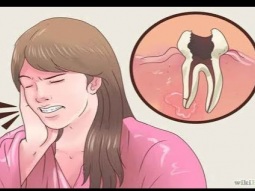 وجع الأسنان طرق لعلاج ألم الأسنان || طرق منزلية
