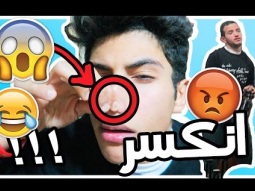 مقلب انكسر خشمي ، ضربني ضرب !!!