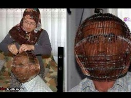 رجل تركي يضع قفصاً حديدياً على رأسه والمفتاح مع زوجته فقط !! - ولكن لماذا ؟؟