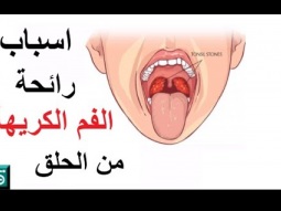 رائحة الفم الكريهة من الحلق || أسباب وراء رائحة الفم الكريهة