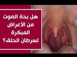 هل بحة الصوت من الأعراض المبكرة لسرطان الحلق؟
