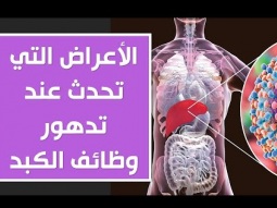 الأعراض التي تحدث عند تدهور وظائف الكبد