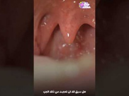 ما فائدة اللهاه فى فمك ؟
