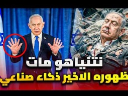 اصبع سادس في يد نتنياهو يكشف زيف ظهوره الاخير .. نتنياهو مات بصواريخ إيران