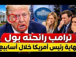موت ترامب خلال أسابيع .. تقارير طبية : ترامب رائحته بول ونهايته وشيكة